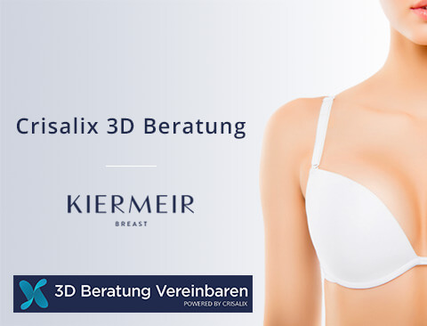 Crisalix-3D Beratung in Bern/Schweiz - Kiermeir Breast 