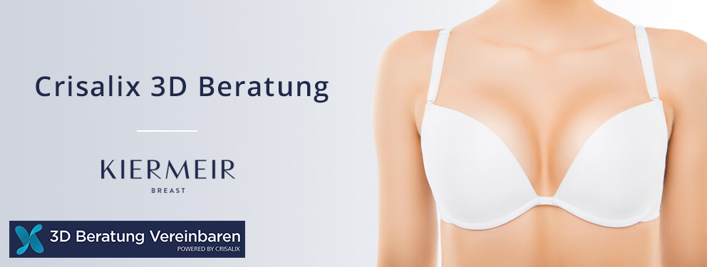 Crisalix-3D Beratung in Bern/Schweiz - Kiermeir Breast 