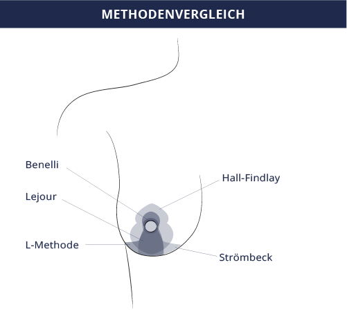grafik_methodenvergleich_kiermeir_bern.png 